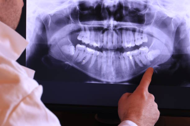 Best Emergency Cosmetic Dentistry (e.g., broken veneers) in Riviera Beach, MD