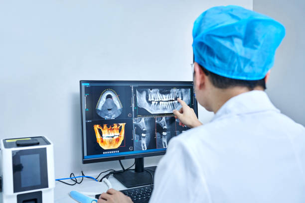 Best Emergency Wisdom Tooth Extraction in Riviera Beach, MD